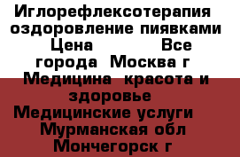 Иглорефлексотерапия, оздоровление пиявками › Цена ­ 3 000 - Все города, Москва г. Медицина, красота и здоровье » Медицинские услуги   . Мурманская обл.,Мончегорск г.